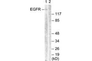 Western blot analysis of extracts from Jurkat cells, using EGFR (Ab-1069) Antibody. (EGFR 抗体  (AA 1031-1080))