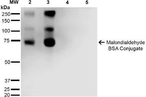 Western Blot analysis of Malondialdehyde-BSA Conjugate showing detection of 67 kDa Malondialdehyde -BSA using Mouse Anti-Malondialdehyde Monoclonal Antibody, Clone 11E3 . (Malondialdehyde 抗体  (FITC))