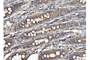 IHC analysis of CLPB using anti-CLPB antibody (ABIN7601732). (CLPB 抗体  (AA 438-707))