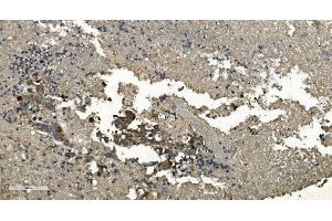 IHC analysis of RGS6 using anti-RGS6 antibody (ABIN7602326).