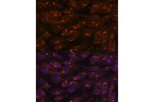 Immunofluorescence analysis of C6 cells using G antibody (ABIN6133219, ABIN6140940, ABIN6140941 and ABIN6222644) at dilution of 1:100. (GALNT2 抗体  (AA 442-571))