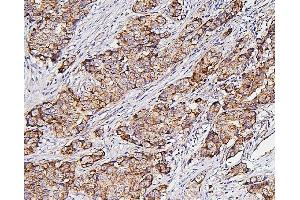 IHC analysis of Hexokinase 1/HK1 using anti-Hexokinase 1/HK1 antibody (ABIN7600260).