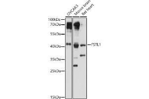 Western blot analysis of extracts of various cell lines, using FSTL1 antibody (ABIN7267227) at 1:1000 dilution. (FSTL1 抗体  (AA 1-308))