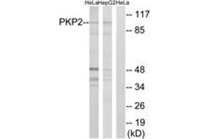 Western blot analysis of extracts from HeLa/HepG2 cells, using PKP2 Antibody. (Plakophilin 2 抗体  (AA 632-681))