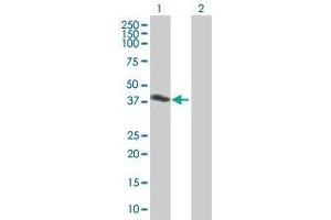 Western Blotting (WB) image for AIM2 293T Cell Transient Overexpression Lysate(Denatured) (ABIN1334544)