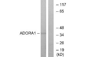 Western blot analysis of extracts from MCF-7 cells, using ADORA1 antibody. (ADORA1 抗体  (C-Term))
