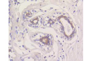 Immunohistochemistry of paraffin-embedded human breast using MCL1 antibody (ABIN4904325) at dilution of 1:100 (40x lens). (MCL-1 抗体)