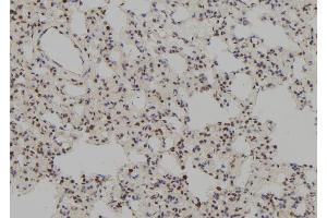 ABIN6277698 at 1/100 staining Rat lung tissue by IHC-P. (MSH3 抗体  (N-Term))