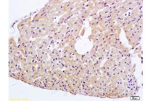 Formalin-fixed and paraffin embedded rat heart tissue labeled with Anti-ERK4 Polyclonal Antibody, Unconjugated (ABIN754288) at 1:200 followed by conjugation to the secondary antibody and DAB staining (MAPK7 抗体  (AA 401-500))