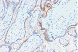 Formalin-fixed, paraffin-embedded human placenta stained with hCG beta Mouse Recombinant Monoclonal Antibody (rHCGb/54). (Recombinant CGB 抗体)