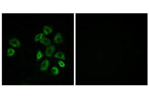 Immunofluorescence analysis of MCF-7 cells, using GPRC5B antibody. (GPRC5B 抗体  (Internal Region))