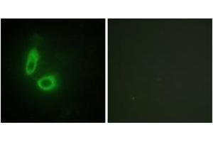 Immunofluorescence analysis of HeLa cells, using EFNA1 Antibody. (Ephrin A1 抗体  (AA 66-115))