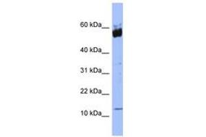 Image no. 1 for anti-S100 Calcium Binding Protein A9 (S100A9) (N-Term) antibody (ABIN6741664) (S100A9 抗体  (N-Term))