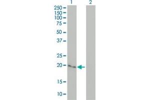 Western Blotting (WB) image for anti-Cytoglobin (CYGB) (AA 1-190) antibody (ABIN566715)
