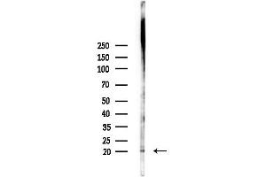 Western blot analysis of lysates from PC12 cells(heat-shock,45 min treatment), using GAS3 Antibody at 1/1000 dilution.