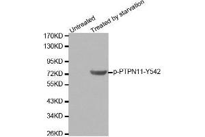 Western blot analysis of extracts from 293 cells using Phospho-PTPN11-Y542 antibody. (PTPN11 抗体  (pTyr542))