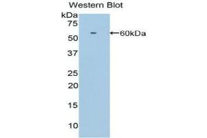 Detection of Recombinant LRP8, Human using Polyclonal Antibody to Low Density Lipoprotein Receptor Related Protein 8 (LRP8) (LRP8 抗体  (AA 696-941))