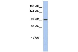 PMS2 antibody used at 1 ug/ml to detect target protein. (PMS2 抗体)