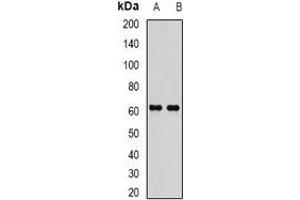 Western blot analysis of EPHX2 expression in MCF7 (A), Jurkat (B) whole cell lysates. (EPHX2 抗体)