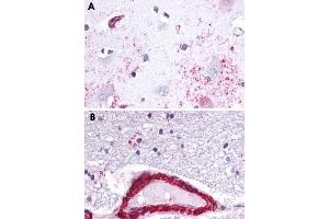 Immunohistochemical staining of formalin-fixed, paraffin-embedded human brain, astrocytes tissue after heat-induced antigen retrieval. (Apelin Receptor 抗体  (3rd Cytoplasmic Domain))
