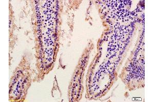 Formalin-fixed and paraffin embedded mouse intestine labeled with Anti ASBT/SLC10A2 Polyclonal Antibody, Unconjugated  at 1:200 followed by conjugation to the secondary antibody and DAB staining. (SLC10A2 抗体  (AA 131-230))