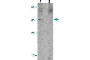Western blot analysis of PRKCDBP in A-20 cell lysate with PRKCDBP polyclonal antibody  at 1 ug/mL in (lane 1) the absence and (lane 2) the presence of blocking peptide. (PRKCDBP 抗体  (Internal Region))