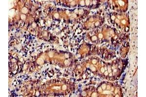 Immunohistochemistry of paraffin-embedded human small intestine tissue using ABIN7156899 at dilution of 1:100 (IL-34 抗体  (AA 191-240))