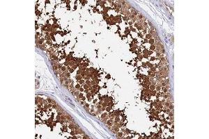 Immunohistochemical staining of human testis with LDHC polyclonal antibody ( Cat # PAB28316 ) shows strong cytoplasmic and nuclear positivity in cells in seminiferus ducts at 1:2500 - 1:5000 dilution. (Lactate Dehydrogenase C 抗体)