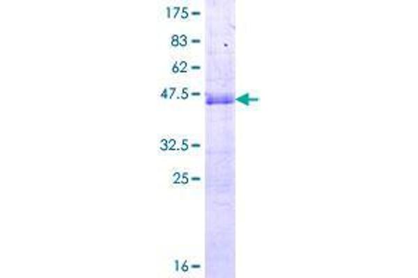 SNX20 Protein (AA 1-129) (GST tag)
