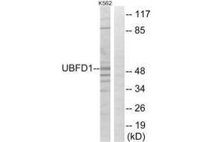 Western blot analysis of extracts from K562 cells, using UBFD1 antibody. (UBFD1 抗体)