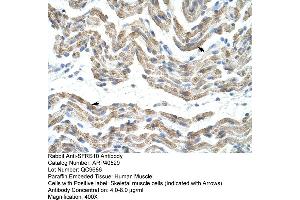 Rabbit Anti-SFRS10 Antibody  Paraffin Embedded Tissue: Human Muscle Cellular Data: Skeletal muscle cells Antibody Concentration: 4. (TRA2B 抗体  (Middle Region))