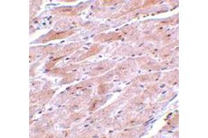 Immunohistochemistry of TRPC3 in mouse heart tissue with TRPC3 polyclonal antibody  at 10 ug/mL . (TRPC3 抗体  (N-Term))
