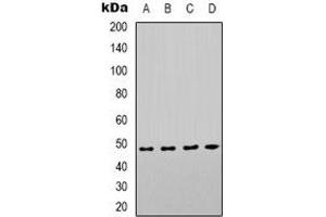 Western blot analysis of COX10 expression in Hela (A), HEK293T (B), mouse kidney (C), mouse brain (D) whole cell lysates. (COX10 抗体)