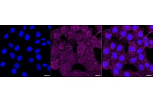 anti-Ras Homolog Enriched in Brain (RHEB) antibody