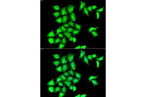 Immunofluorescence analysis of HeLa cells using MSRB1 antibody (ABIN5974074). (MSRB1 抗体)