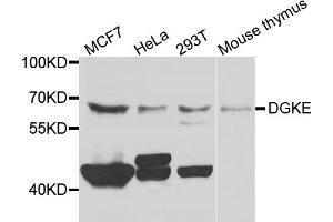 Western blot analysis of extracts of various cell lines, using DGKE antibody. (DGKE 抗体)