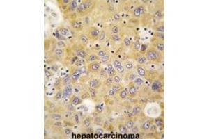 Immunohistochemistry (IHC) image for anti-Alanyl-tRNA Synthetase 2, Mitochondrial (AARS2) antibody (ABIN3003290) (AARS2 抗体)