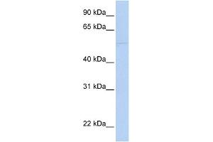 WB Suggested Anti-PRF1 Antibody Titration:  0. (Perforin 1 抗体  (N-Term))