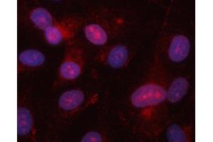 IF analysis of EIF2AK1 using anti-EIF2AK1 antibody (ABIN7601508).