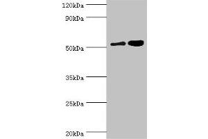 Western blot All lanes: Dipeptidyl peptidase 2 antibody at 6 μg/mL Lane 1: K562 whole cell lysate Lane 2: Rat brain tissue Secondary Goat polyclonal to rabbit IgG at 1/10000 dilution Predicted band size: 54 kDa Observed band size: 54 kDa (DPP7 抗体  (AA 190-410))