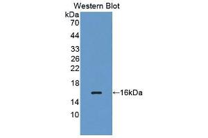 Western blot analysis of the recombinant protein. (MARS 抗体  (AA 74-198))