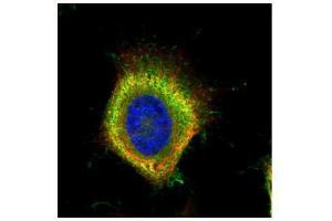 ICC/IF Image Confocal immunofluorescence analysis (Olympus FV10i) of paraformaldehyde-fixed HeLa, using Fatty Acid Synthase, antibody (Green) at 1:500 dilution. (Fatty Acid Synthase 抗体  (N-Term))