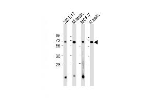 All lanes : Anti-FEM1B Antibody (C-Term) at 1:2000 dilution Lane 1: 293T/17 whole cell lysate Lane 2: mouse testis lysate Lane 3: MCF-7 whole cell lysate Lane 4: rat testis lysate Lysates/proteins at 20 μg per lane. (FEM1B 抗体  (AA 547-579))