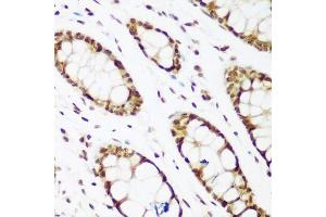 Immunohistochemistry (Paraffin-embedded Sections) (IHC (p)) image for anti-Proliferating Cell Nuclear Antigen (PCNA) (AA 1-261) antibody (ABIN3020826)