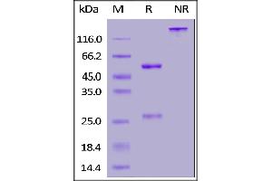 Anti-SARS-CoV-2 Spike RBD Antibody, Chimeric mAb, Human IgG1 (ABIN6953206) on SDS-PAGE under reducing (R) and non-reducing (NR) conditions. (SARS-CoV-2 Spike S1 抗体)