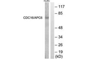 Western Blotting (WB) image for anti-Cell Division Cycle 16 Homolog (S. Cerevisiae) (CDC16) (AA 526-575) antibody (ABIN2888871) (CDC16 抗体  (AA 526-575))