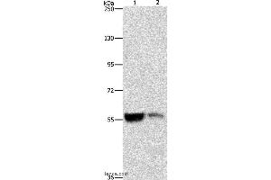 Western blot analysis of Mouse liver and kidney tissue, using ALDH8A1 Polyclonal Antibody at dilution of 1:550 (ALDH8A1 抗体)