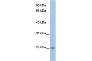 WB Suggested Anti-UBE2M  Antibody Titration: 0. (UBE2M 抗体  (N-Term))
