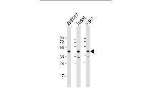All lanes : Anti-PHF6 Antibody (Center) at 1:2000 dilution Lane 1: 293T/17 whole cell lysate Lane 2: Jurkat whole cell lysate Lane 3: K562 whole cell lysate Lysates/proteins at 20 μg per lane. (PHF6 抗体  (AA 148-180))