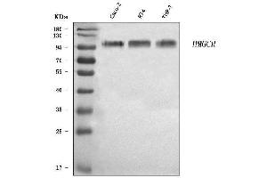 Western blot analysis of HMGCR using anti-HMGCR antibody (ABIN7600989).